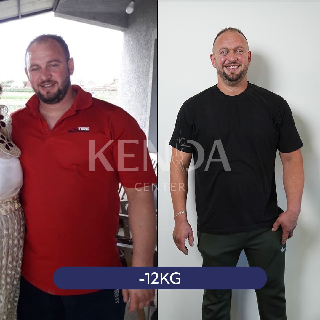 Kenda before-and-after result 7
