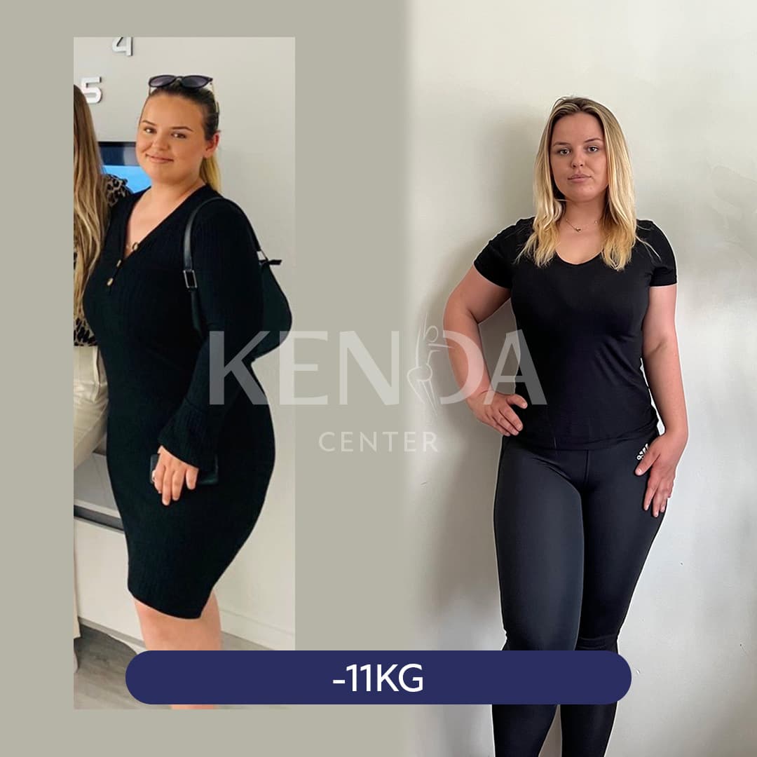 Kenda before-and-after result 2