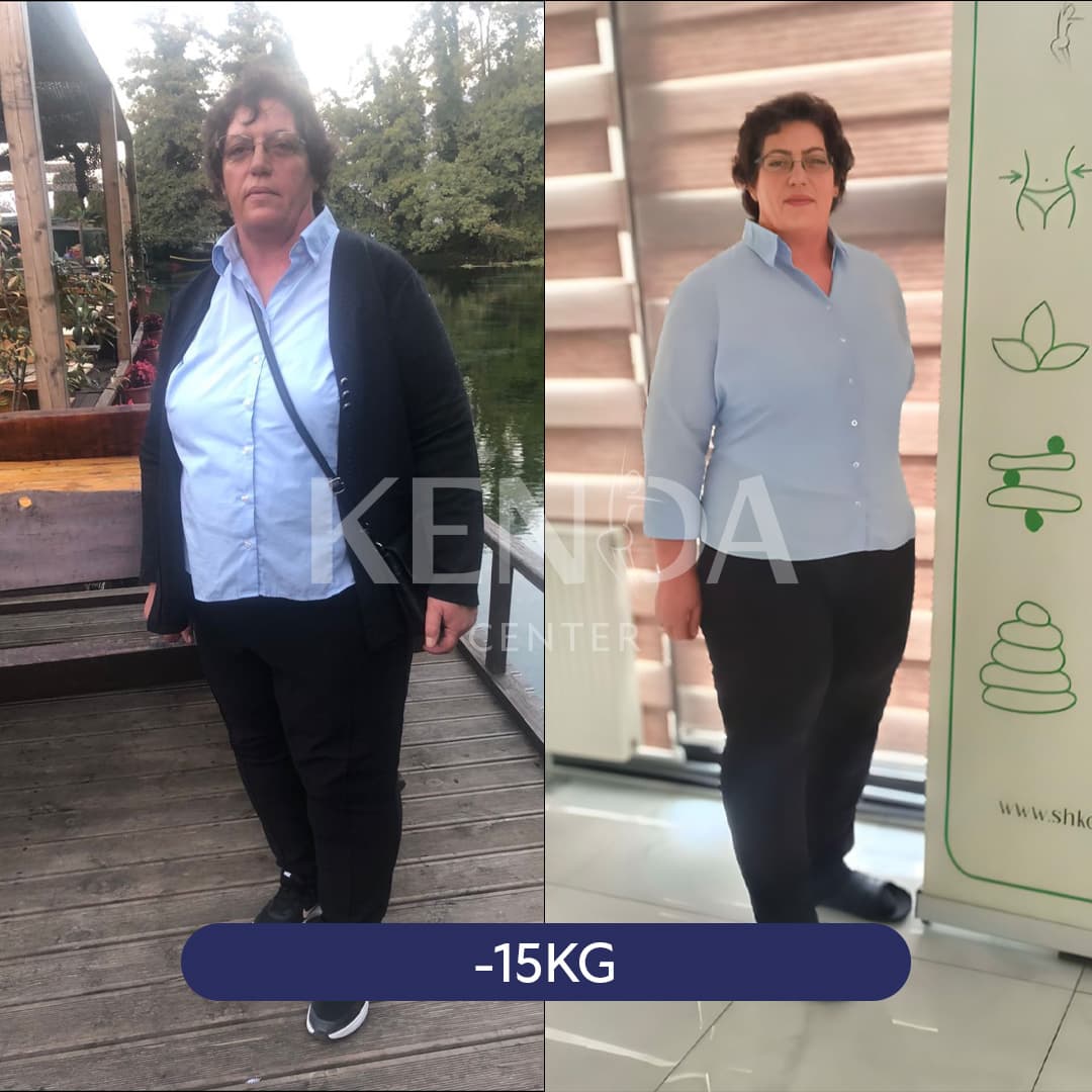 Kenda before-and-after result 3