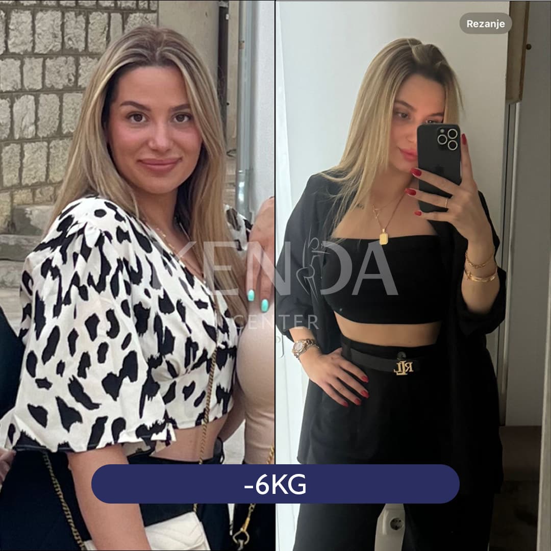 Kenda before-and-after result 6