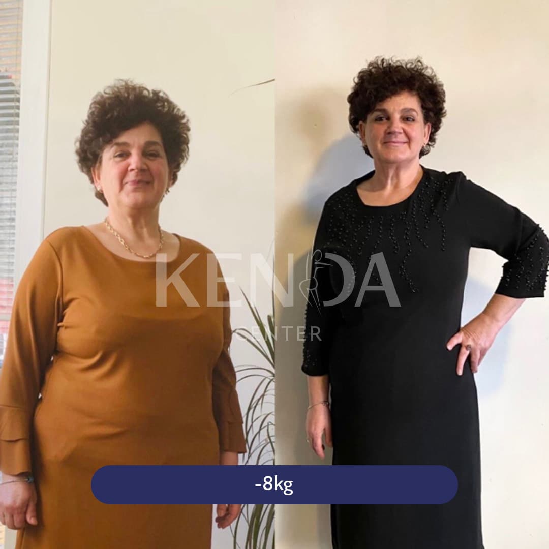 Kenda before-and-after result 4