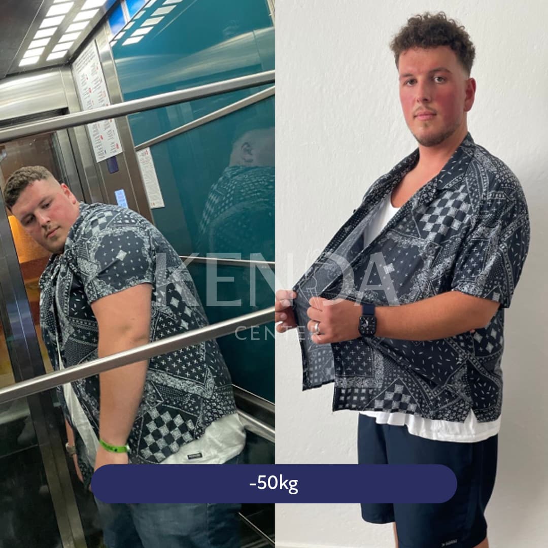 Kenda before-and-after result 1