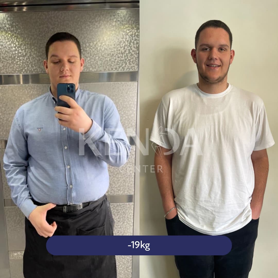 Kenda before-and-after result 6