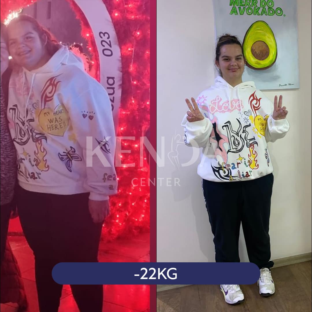 Kenda before-and-after result 3
