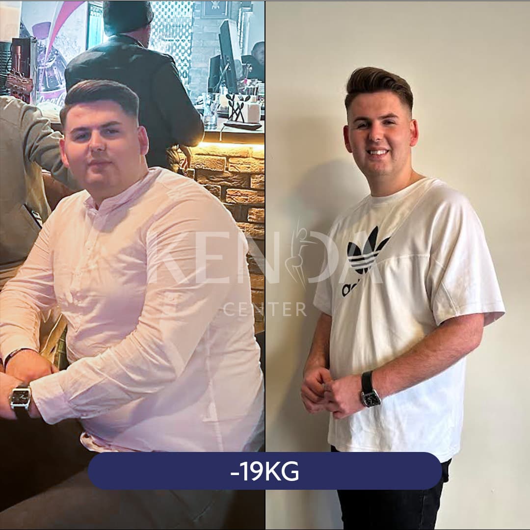Kenda before-and-after result 4