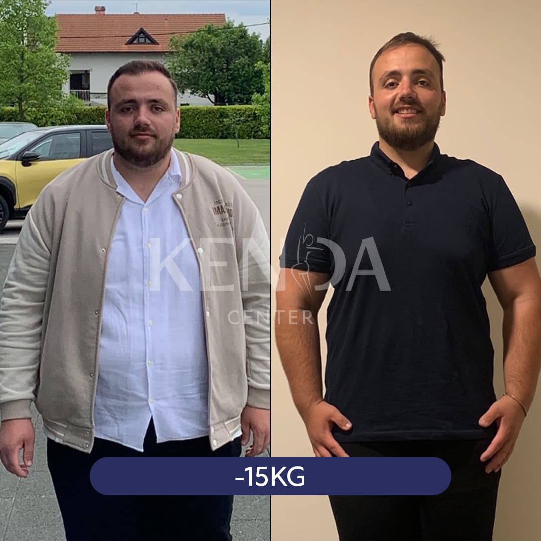 Kenda before-and-after result 7