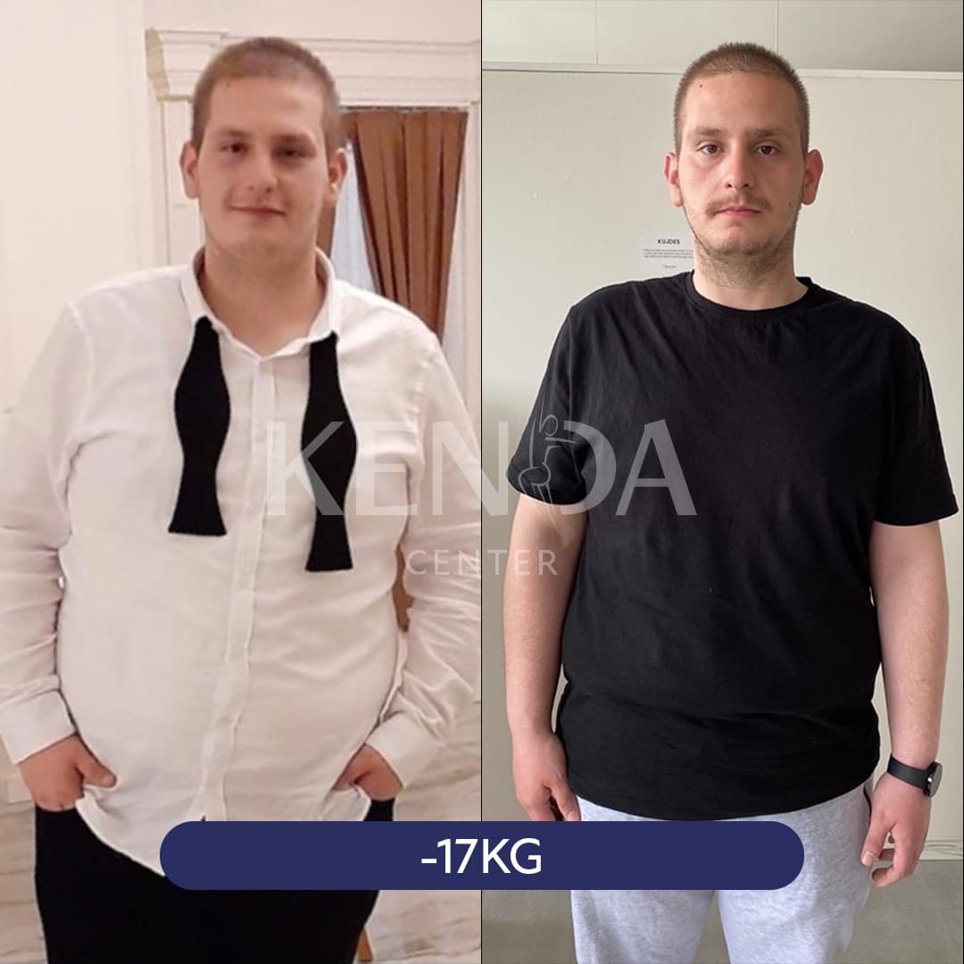 Kenda before-and-after result 2