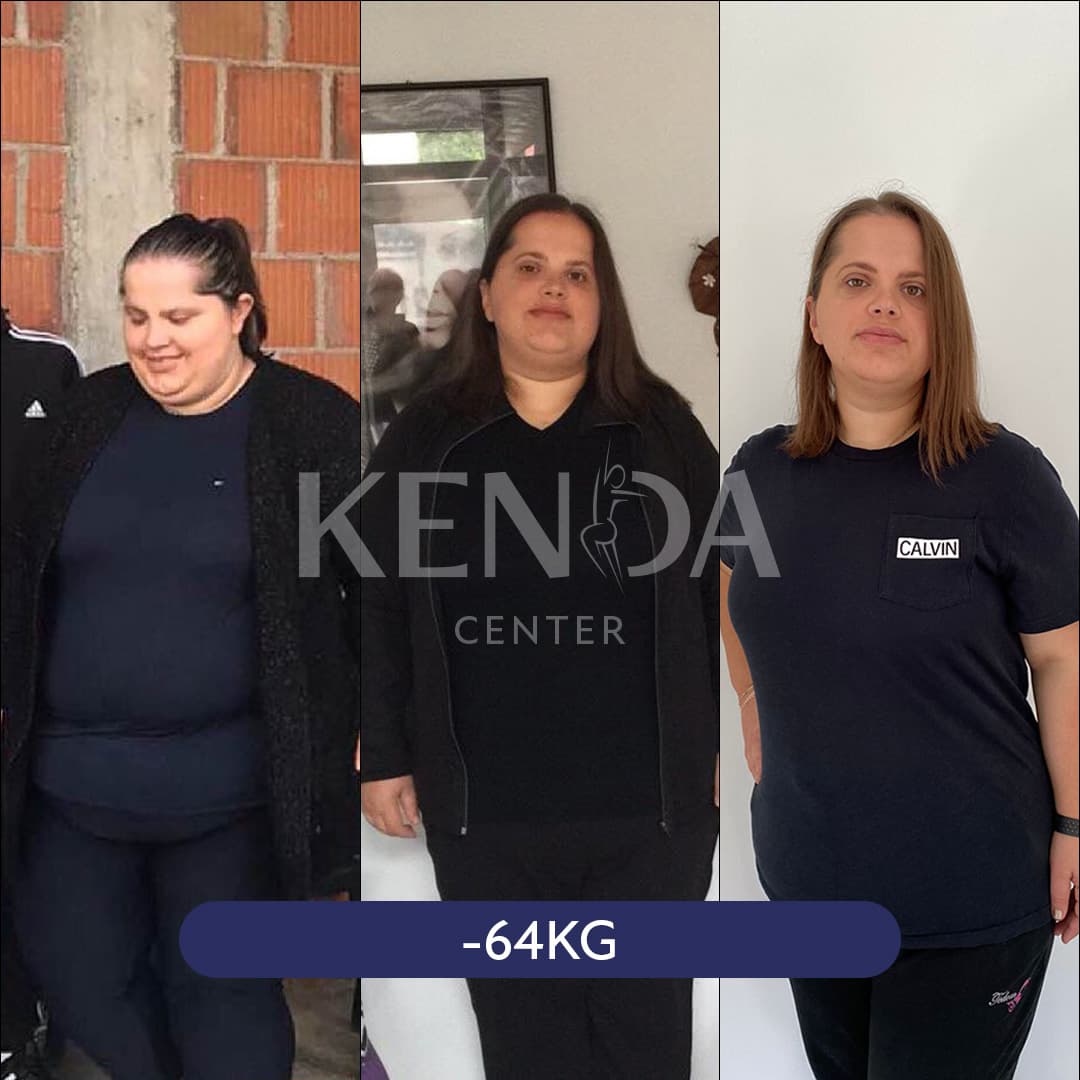 Kenda before-and-after result 1